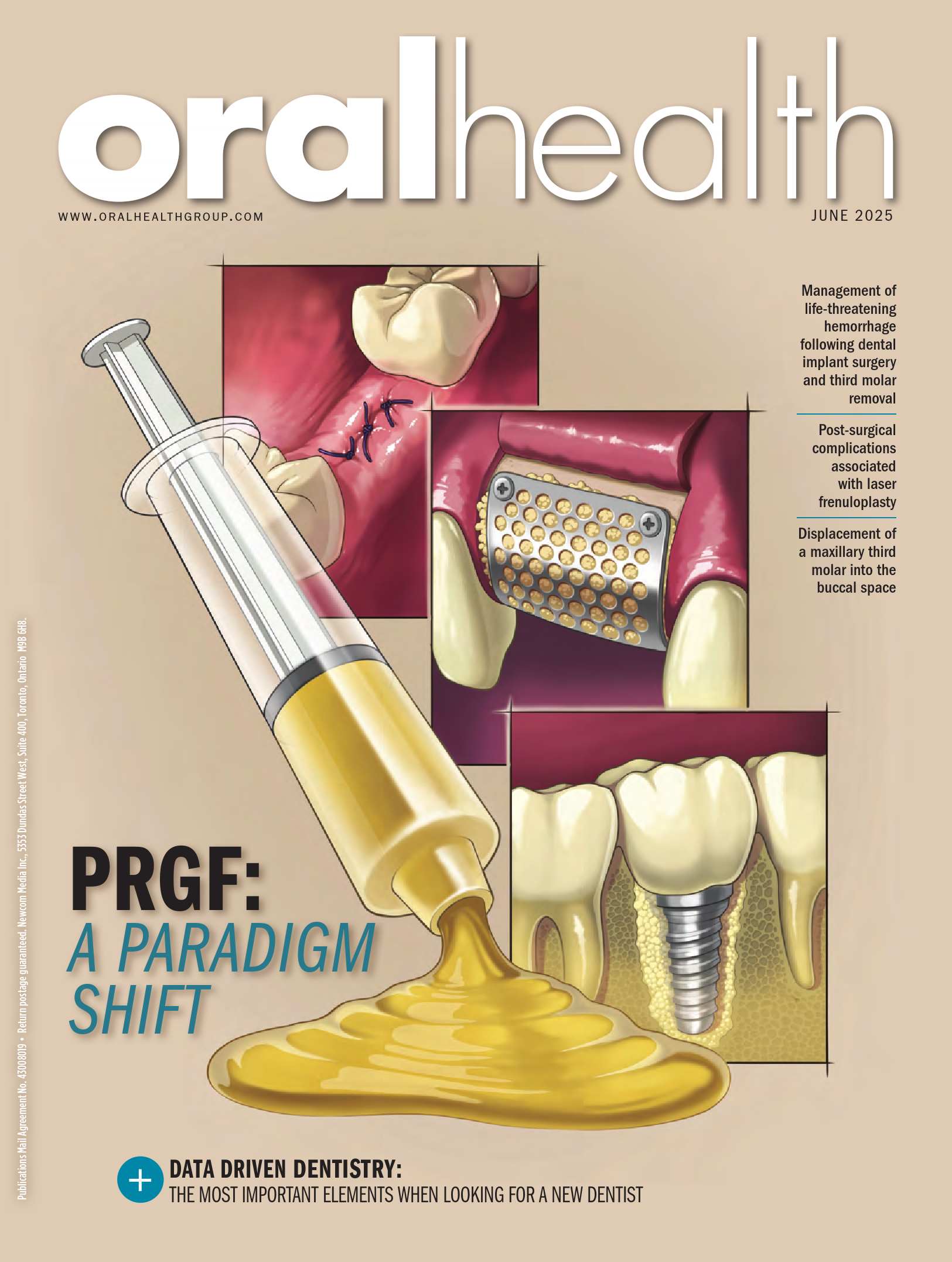 Oral Health – 4 juin 2025